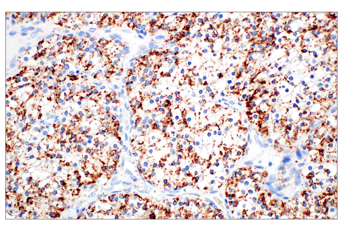Immunohistochemistry Image 4: Perilipin-2 (E6G6M) Rabbit mAb