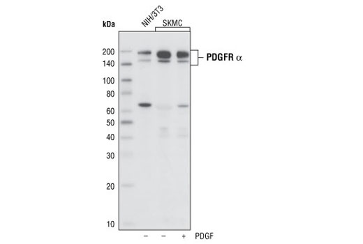 Western Blotting Image 1: PDGF Receptor α (D1E1E) XP<sup>®</sup> Rabbit mAb (BSA and Azide Free)