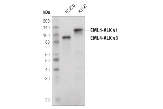 Western Blotting Image 1: ALK (D5F3<sup>®</sup>) XP<sup>®</sup> Rabbit mAb (HRP Conjugate)