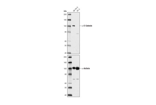 Western Blotting Image 2: α-E-Catenin (D9R5E) Rabbit mAb