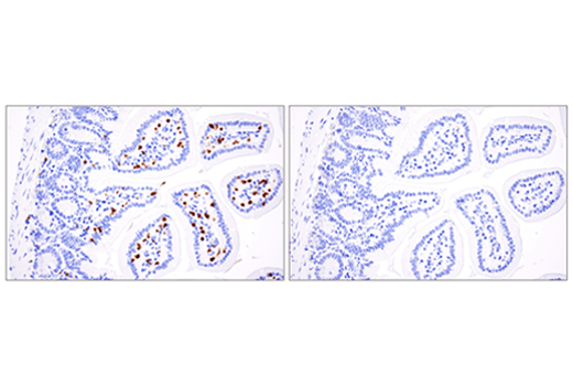 Immunohistochemistry Image 4: CD3ε (E4T1B) XP<sup>®</sup> Rabbit mAb