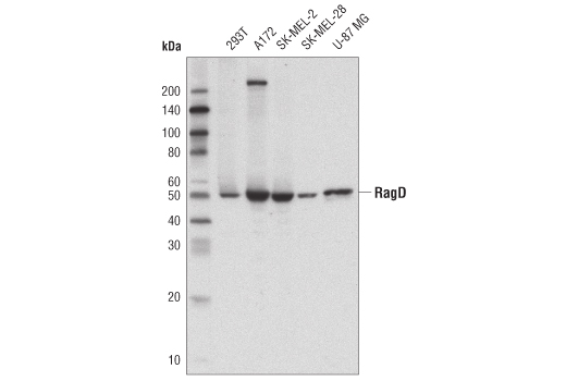 undefined Image 2: Rag and LAMTOR Antibody Sampler Kit