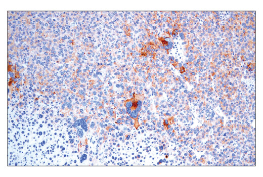 Immunohistochemistry Image 2: CD40 (E2Z7J) Rabbit mAb