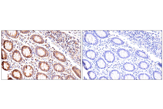 Immunohistochemistry Image 11: G3BP1 (E9G1M) XP<sup>®</sup> Rabbit mAb