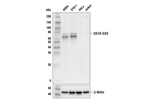 undefined Image 12: BAF Complex IHC Antibody Sampler Kit