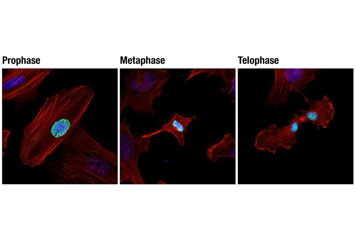 Immunofluorescence Image 1: Phospho-Histone H3 (Ser10) (D7N8E) XP<sup>®</sup> Rabbit mAb (BSA and Azide Free)