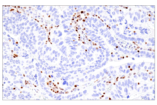 Immunohistochemistry Image 6: RUNX3/AML2 (E8D5W) XP<sup>®</sup> Rabbit mAb