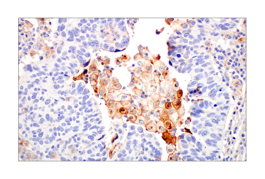 undefined Image 20: Late-Onset Alzheimer's Disease Risk Gene Antibody Sampler Kit