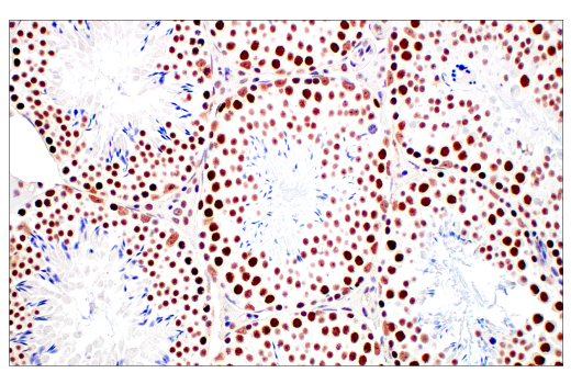 Immunohistochemistry Image 9: METTL14 (E2G9A) Rabbit mAb