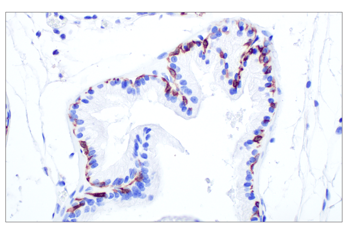 Immunohistochemistry Image 7: Keratin 14 (E7W6V) Rabbit mAb