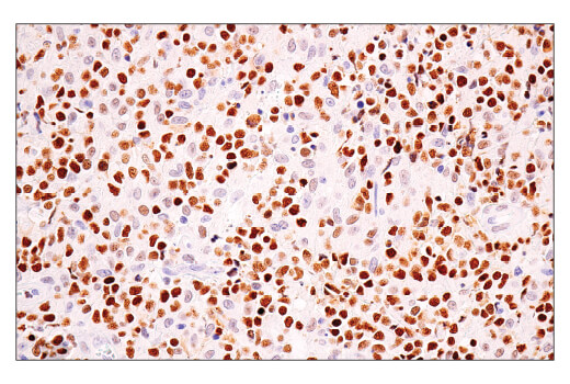 Immunohistochemistry Image 2: BCL6 (E5I8I) Rabbit mAb