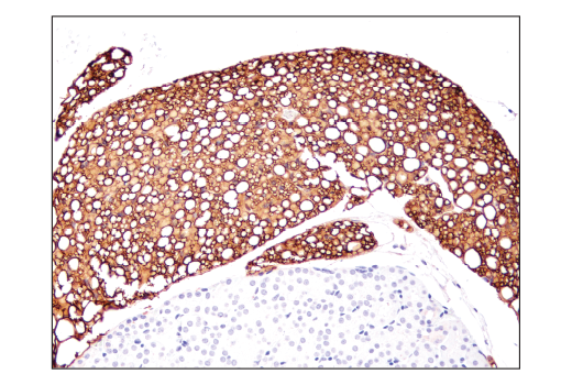 Immunohistochemistry Image 3: Perilipin-1 (D1D8) XP<sup>®</sup> Rabbit mAb