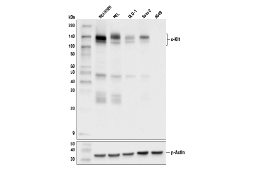 Western Blotting Image 1: c-Kit (D3W6Y) XP<sup>®</sup> Rabbit mAb