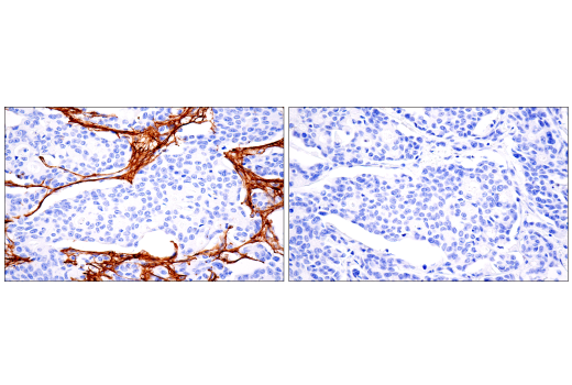 Immunohistochemistry Image 8: COL1A1 (E8F4L) XP<sup>®</sup> Rabbit mAb (BSA and Azide Free)