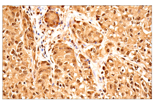 Immunohistochemistry Image 2: Ubiquitin (E6K4Y) XP<sup>®</sup> Rabbit mAb (BSA and Azide Free)