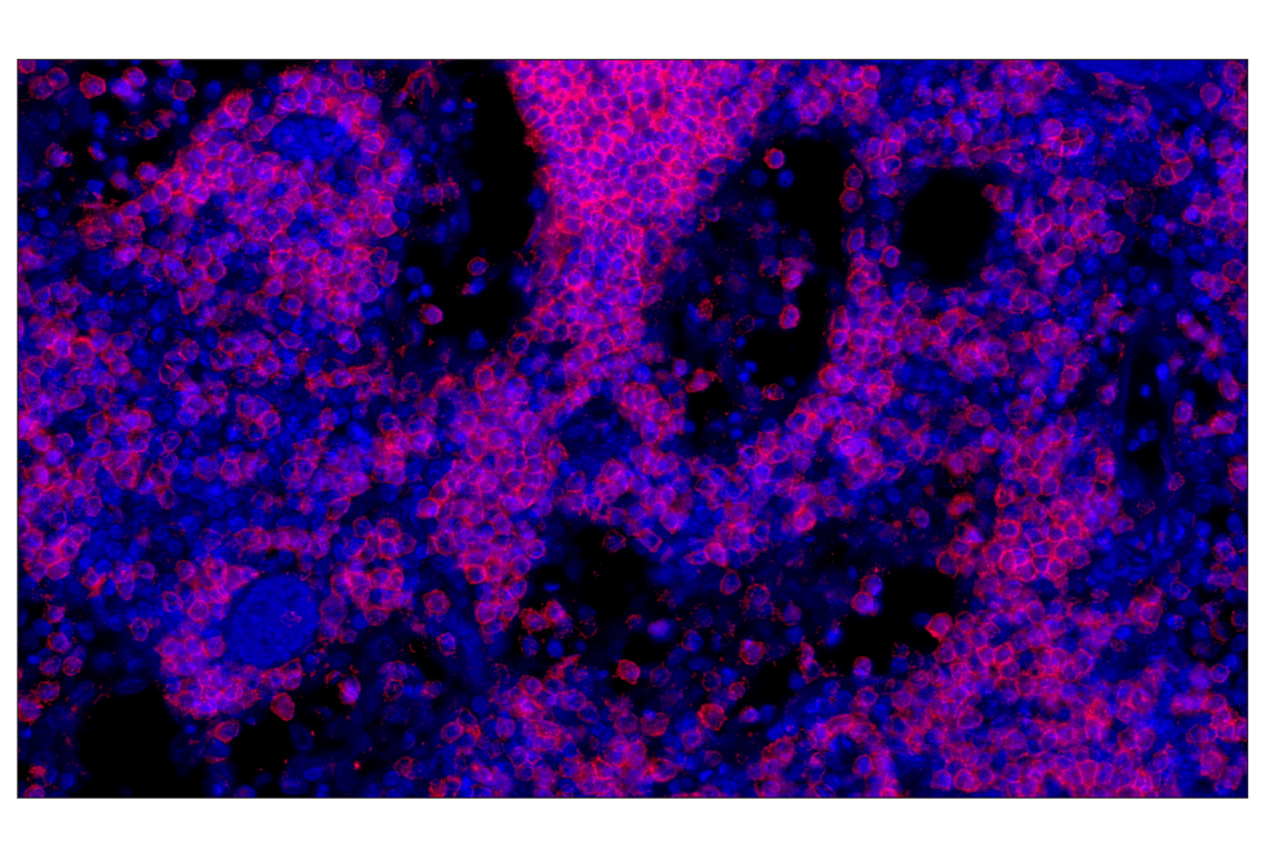 Immunohistochemistry Image 1: CD20 (E7B7T) XP<sup>®</sup> Rabbit mAb (Alexa Fluor<sup>®</sup> 647 Conjugate)