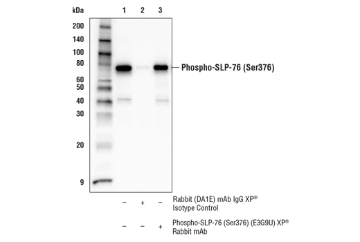 Immunoprecipitation Image 1: Phospho-SLP-76 (Ser376) (E3G9U) XP<sup>®</sup> Rabbit mAb