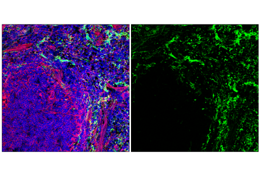 Immunofluorescence Image 1: CD206/MRC1 (E6T5J) XP<sup>®</sup> Rabbit mAb (BSA and Azide Free)