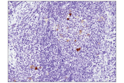 Immunohistochemistry Image 6: TNFRSF8/CD30 (E4L4I) XP<sup>®</sup> Rabbit mAb