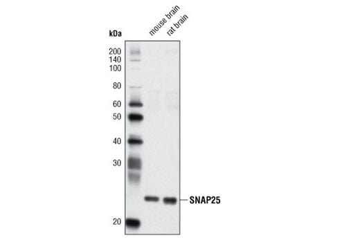 Western Blotting Image 1: SNAP25 (D7B4) Rabbit mAb