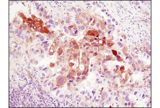 Immunohistochemistry Image 2: NDRG1 (D8G9) XP<sup>®</sup> Rabbit mAb