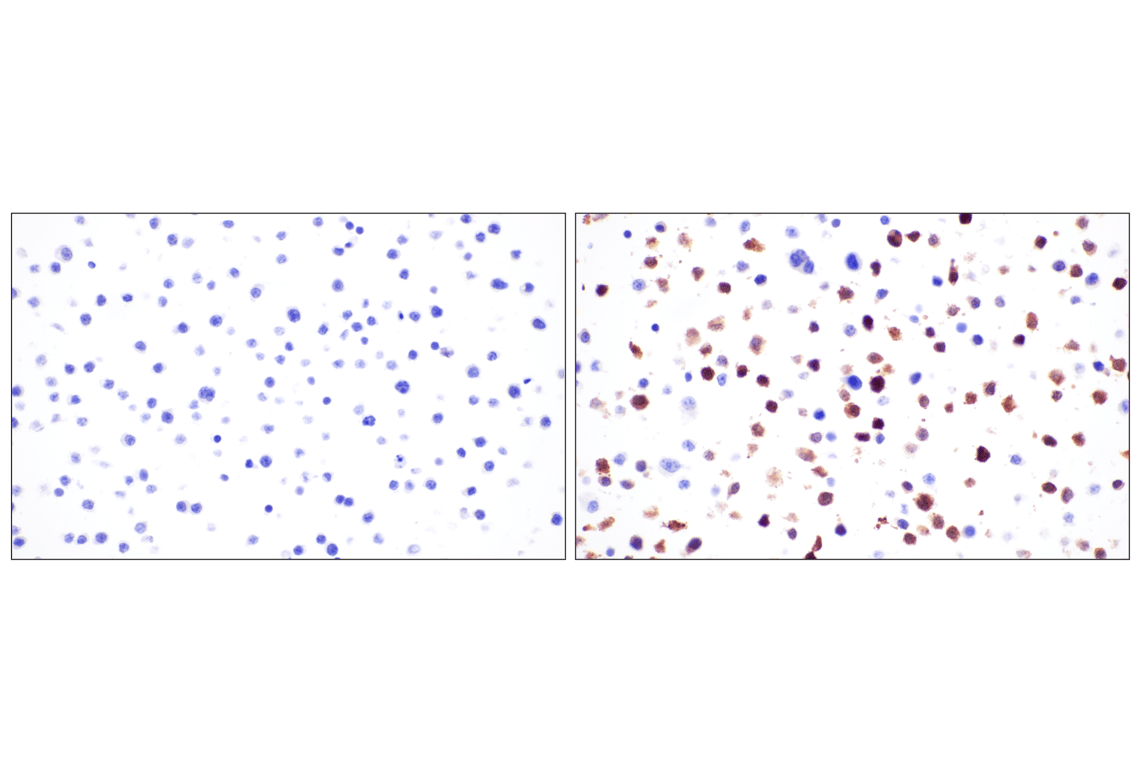 undefined Image 31: Mouse Reactive Pyroptosis Antibody Sampler Kit