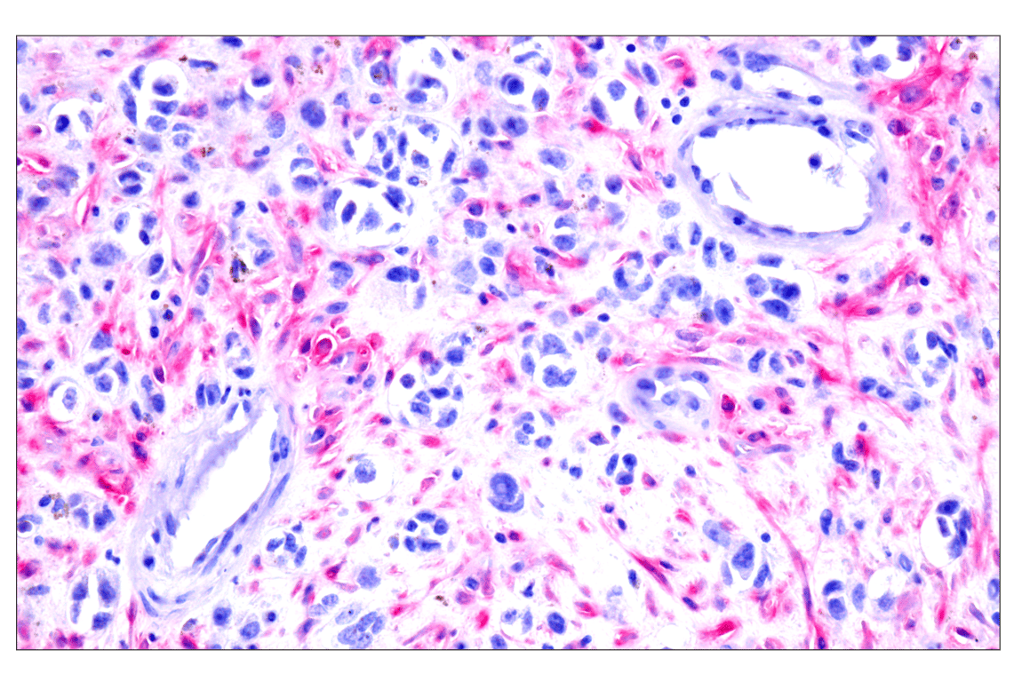 Immunohistochemistry Image 13: FAP (F1A4G) Rabbit mAb (BSA and Azide Free)