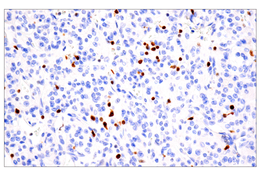 undefined Image 54: Human Exhausted CD8<sup>+</sup> T Cell IHC Antibody Sampler Kit