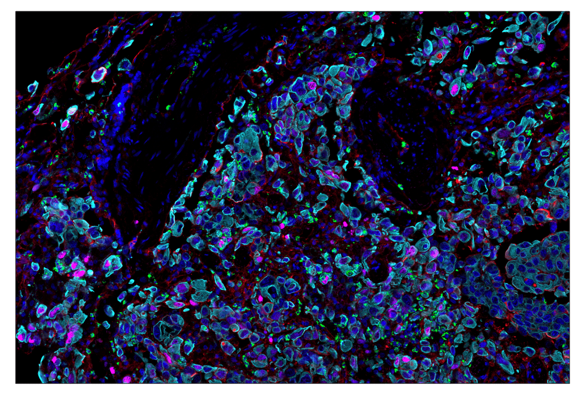 Immunohistochemistry Image 7: Phospho-Histone H2A.X (Ser139) (D7T2V) & CO-0135-647 SignalStar<sup>™</sup> Oligo-Antibody Pair