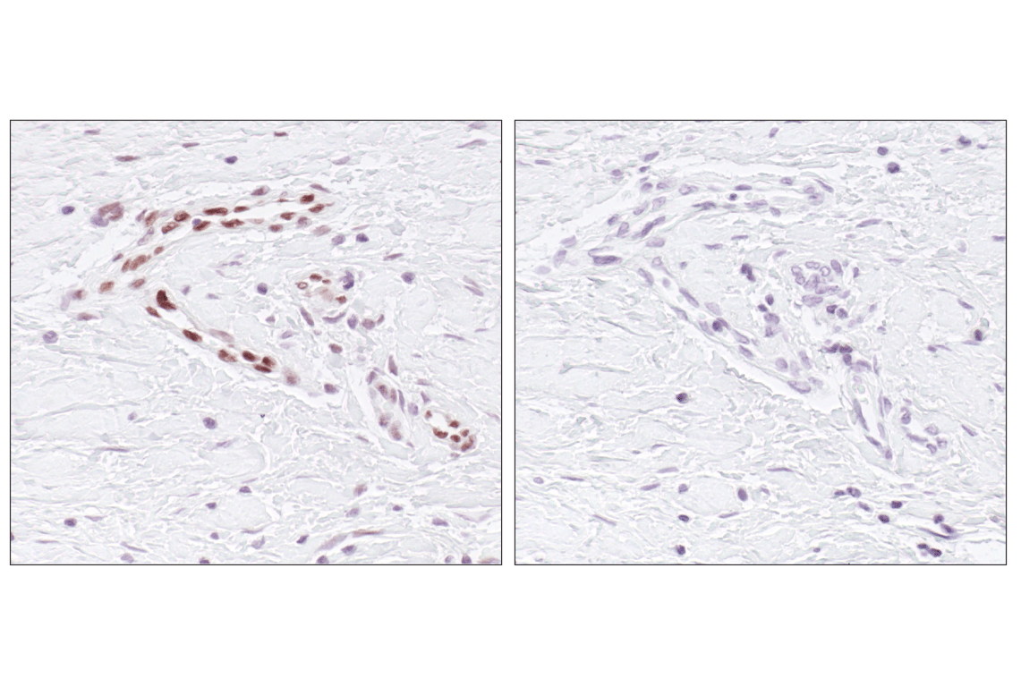 undefined Image 29: Stat3/Stat5 Signaling Antibody Sampler Kit