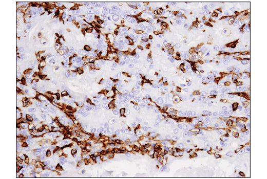 Immunohistochemistry Image 3: CD14 (D7A2T) Rabbit mAb (IHC Formulated)