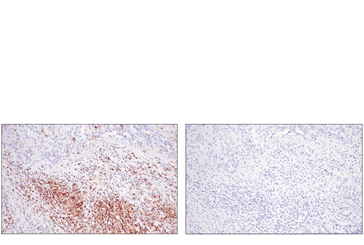 Immunohistochemistry Image 3: CD48 (D7L8I) XP<sup>®</sup> Rabbit mAb (BSA and Azide Free)