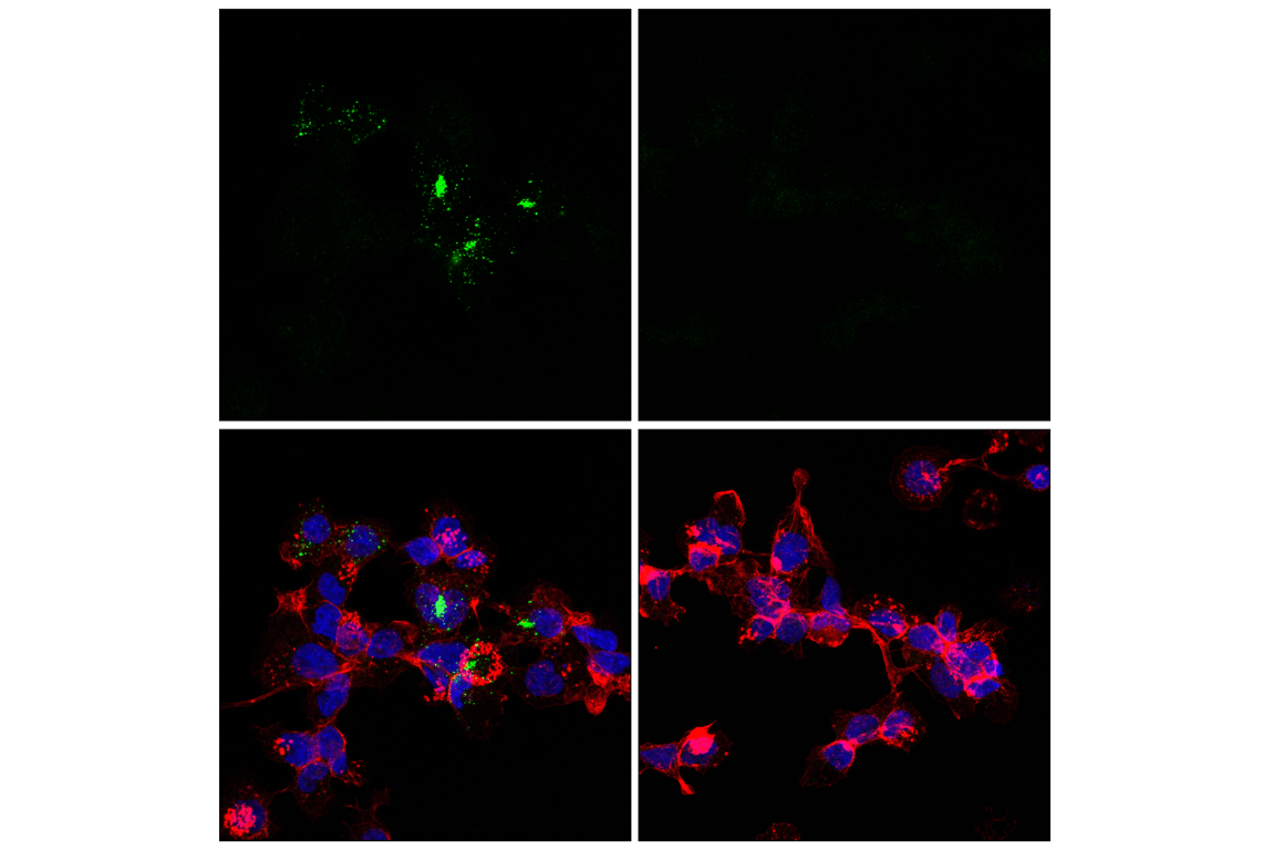 Immunofluorescence Image 1: Phospho-STING (Ser366) (D8K6H) Rabbit mAb (BSA and Azide Free)