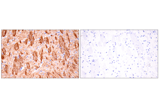 Immunohistochemistry Image 6: Neurofilament-H (E7Z7G) Rabbit mAb