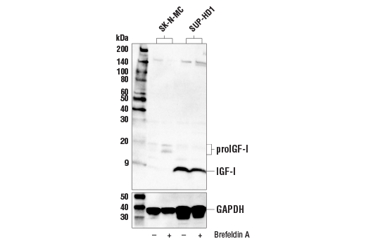 Western Blotting Image 1: IGF-I (E6B7O) Rabbit mAb