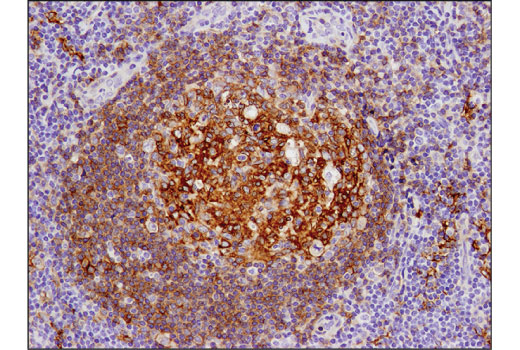 Immunohistochemistry Image 4: CD40 (D8W3N) Rabbit mAb