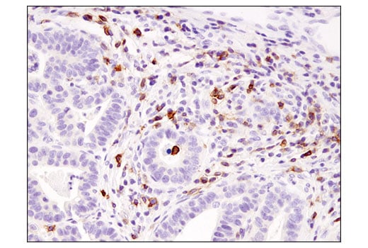 Immunohistochemistry Image 2: ICOS (D1K2T<sup>™</sup>) Rabbit mAb