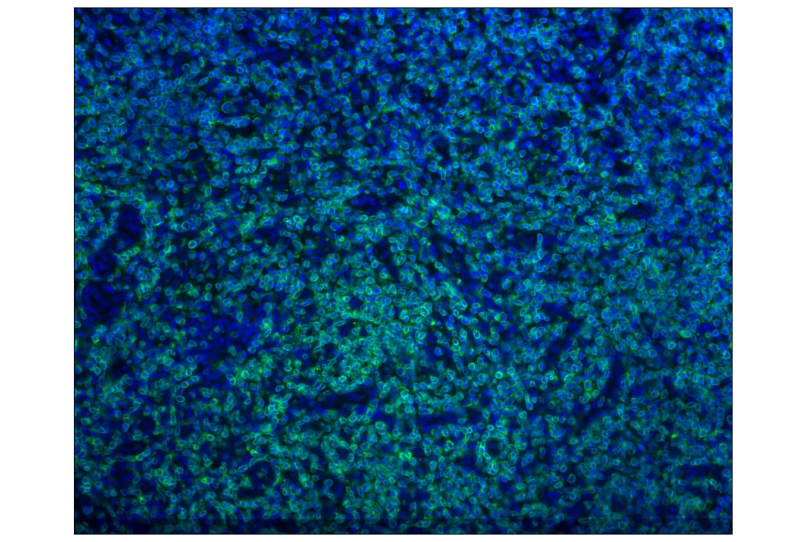 Immunohistochemistry Image 1: CD3ε (D7A6E<sup>™</sup>) XP<sup>®</sup> Rabbit mAb (Alexa Fluor<sup>®</sup> 488 Conjugate)
