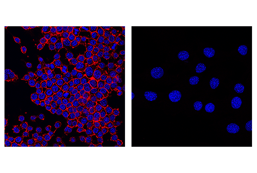 Immunofluorescence Image 1: CD45 (D3F8Q) Rabbit mAb (Alexa Fluor<sup>®</sup> 647 Conjugate)