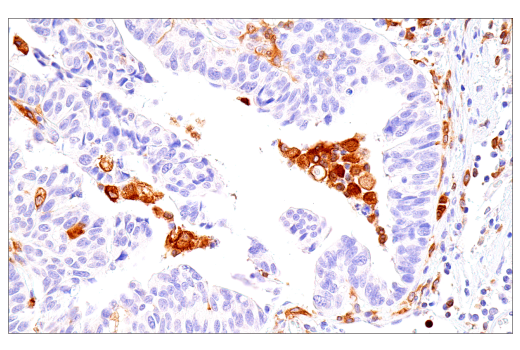Immunohistochemistry Image 5: DAP12 (E8P9U) Rabbit mAb (BSA and Azide Free)