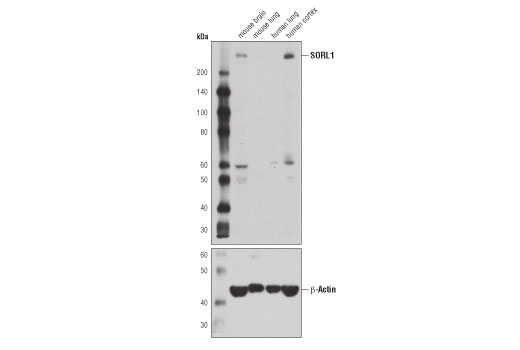 undefined Image 13: Late-Onset Alzheimer's Disease Risk Gene Antibody Sampler Kit