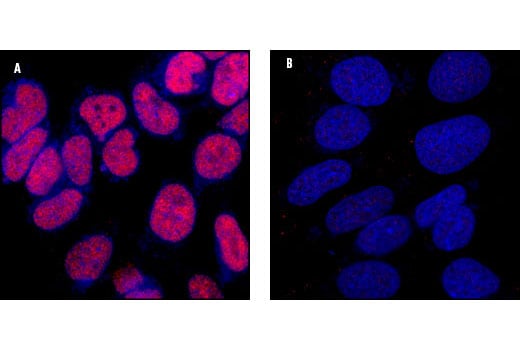 undefined Image 16: PhosphoPlus<sup>®</sup> CREB (Ser133) Antibody Duet