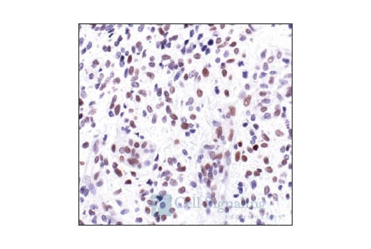 undefined Image 9: PhosphoPlus<sup>®</sup> c-Jun (Ser73) Antibody Duet