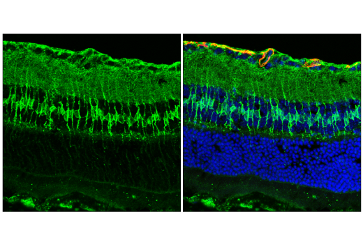 Immunofluorescence Image 1: ApoE (E7X2A) Rabbit mAb (BSA and Azide Free)