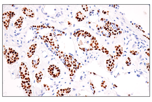 Immunohistochemistry Image 1: Sox10 (E6B6I) XP<sup>®</sup> Rabbit mAb (BSA and Azide Free)