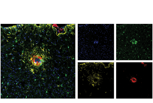 Immunofluorescence Image 1: β-Amyloid (D54D2) XP<sup>®</sup> Rabbit mAb (Alexa Fluor<sup>®</sup> 647 Conjugate)