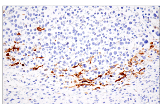 Immunohistochemistry Image 2: iNOS (E1W4J) Rabbit mAb
