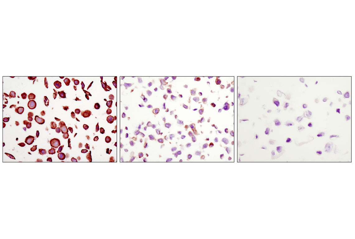 undefined Image 61: Lung Cancer RTK Antibody Sampler Kit