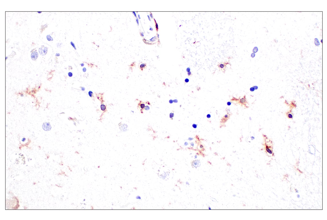 Immunohistochemistry Image 10: CD11b/ITGAM (E3J2F) Rabbit mAb