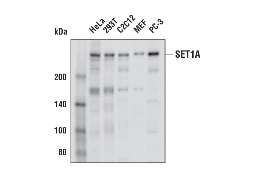Western Blotting Image 1: SET1A (E3E2S) Rabbit mAb